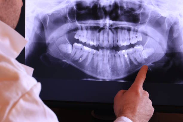 Best Emergency Root Canal Therapy in Clearwater, KS