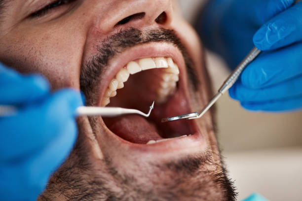 Best Emergency Cosmetic Dentistry (e.g., broken veneers) in Clearwater, KS